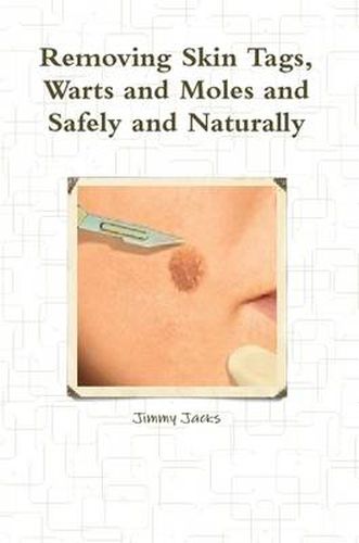 Cover image for Removing Skin Tags, Warts and Moles and Safely and Naturally