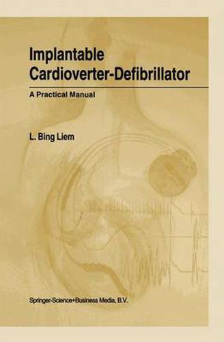 Cover image for Implantable Cardioverter-Defibrillator: A Practical Manual