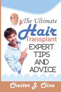 Cover image for The Ultimate Hair Transplant Guide
