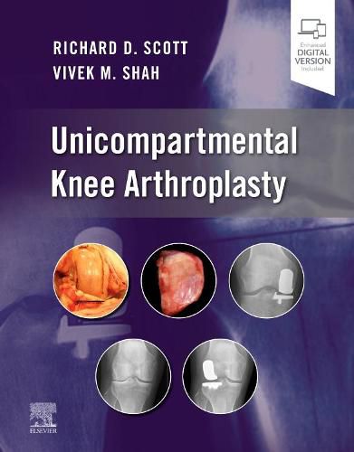 Cover image for Unicompartmental Knee Arthroplasty