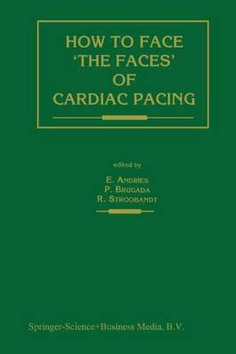Cover image for How to face 'the faces' of CARDIAC PACING