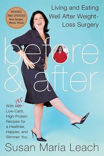 Cover image for Before and After: Living and Eating Well After Weight-loss Surgery