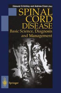 Cover image for Spinal Cord Disease: Basic Science, Diagnosis and Management