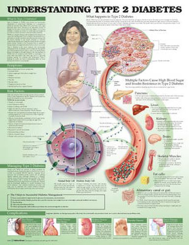 Cover image for Understanding Type 2 Diabetes Anatomical Chart