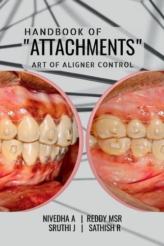 Handbook of "Attachments"