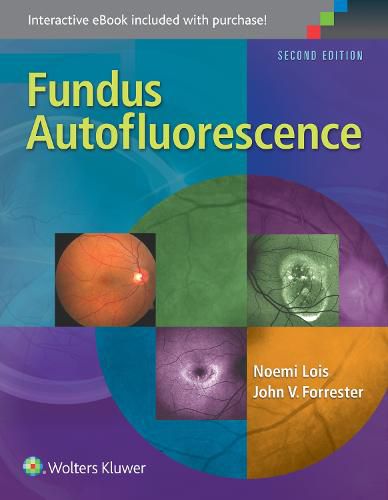 Cover image for Fundus Autofluorescence