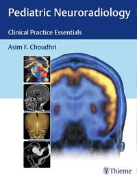 Cover image for Pediatric Neuroradiology: Clinical Practice Essentials