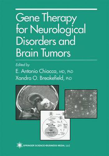 Cover image for Gene Therapy for Neurological Disorders and Brain Tumors
