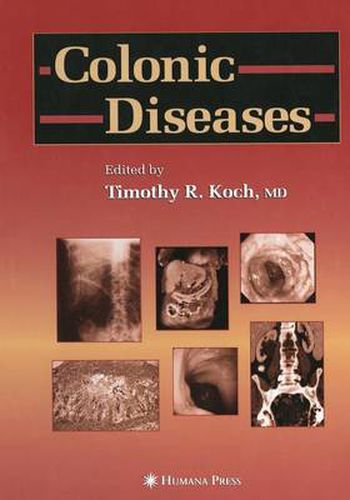 Cover image for Colonic Diseases