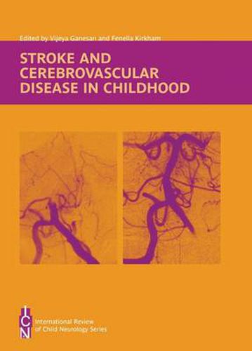 Cover image for Stroke and Cerebrovascular Disease in Childhood