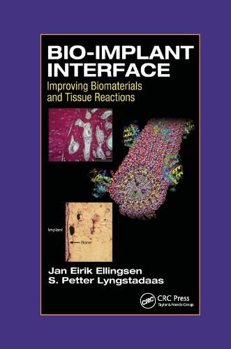 Cover image for Bio-Implant Interface: Improving Biomaterials and Tissue Reactions