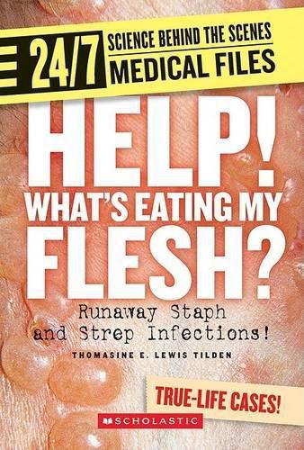 Cover image for Help! Whats Eating My Flesh?: Runaway Staph and Strep Infections!