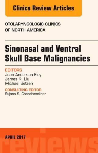 Sinonasal and Ventral Skull Base Malignancies, An Issue of Otolaryngologic Clinics of North America