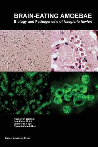 Brain-Eating Amoebae: Biology and Pathogenesis of Naegleria Fowleri