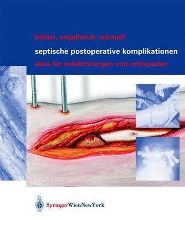 Cover image for Septische postoperative Komplikationen: Atlas fur Unfallchirurgen und Orthopaden