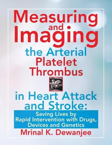 Cover image for Measuring and Imaging the Arterial Platelet Thrombus in Heart Attack and Stroke