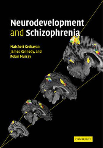 Cover image for Neurodevelopment and Schizophrenia