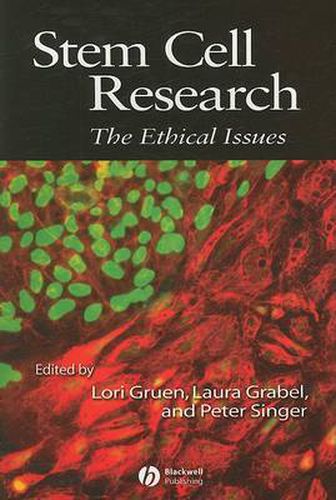 Stem Cell Research: The Ethical Issues