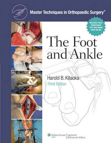 Cover image for Master Techniques in Orthopaedic Surgery: The Foot and Ankle