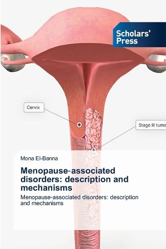 Cover image for Menopause‐associated disorders