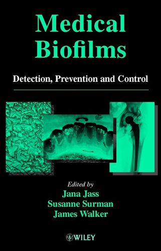Cover image for Medical Biofilms: Detection, Prevention and Control