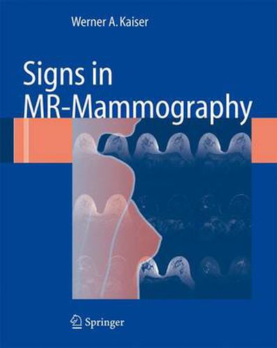 Cover image for Signs in MR-Mammography