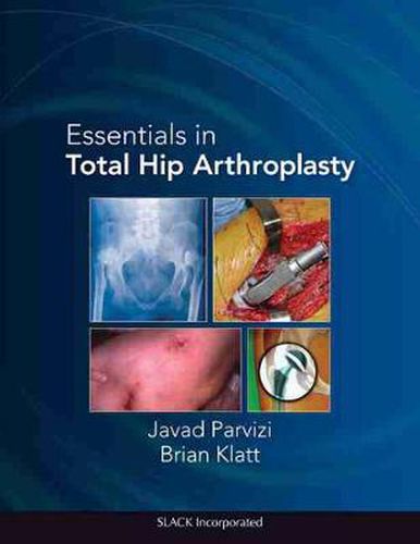 Cover image for Essentials in Total Hip Arthroplasty