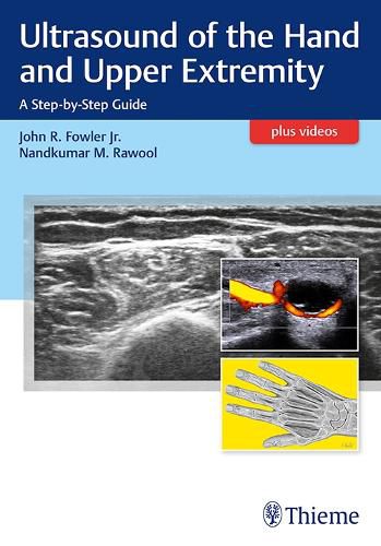 Ultrasound of the Hand and Upper Extremity: A Step-by-Step Guide