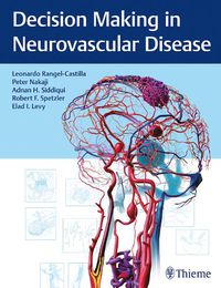 Cover image for Decision Making in Neurovascular Disease