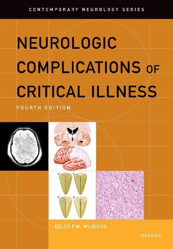 Cover image for Neurologic Complications of Critical Illness