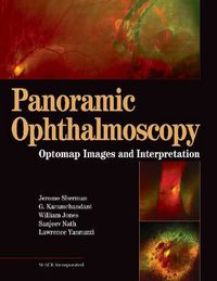 Cover image for Panoramic Ophthalmoscopy: Optomap Images and Interpretation