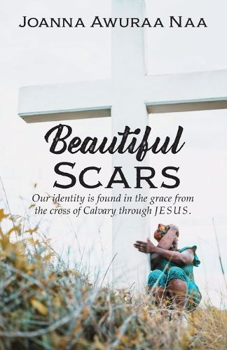 Cover image for Beautiful Scars