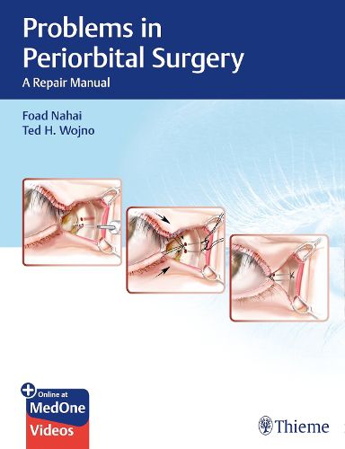 Cover image for Problems in Periorbital Surgery: A Repair Manual