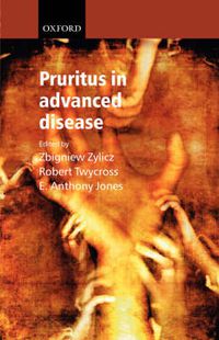 Cover image for Pruritus in Advanced Disease