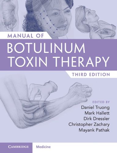 Manual of Botulinum Toxin Therapy