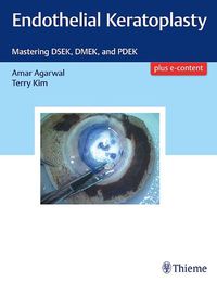 Cover image for Endothelial Keratoplasty: Mastering DSEK, DMEK, and PDEK