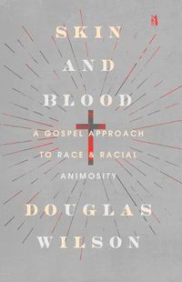 Cover image for Skin and Blood