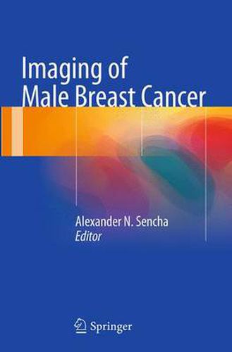 Cover image for Imaging of Male Breast Cancer