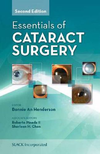 Cover image for Essentials of Cataract Surgery