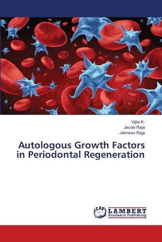 Cover image for Autologous Growth Factors in Periodontal Regeneration