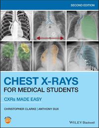 Cover image for Chest X-rays for Medical Students - CXRs Made Easy  2nd Edition