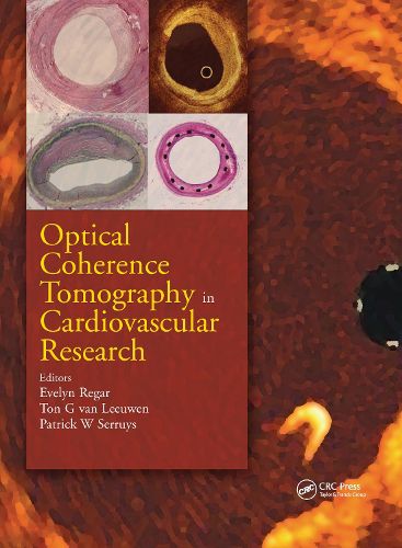 Cover image for Optical Coherence Tomography in Cardiovascular Research