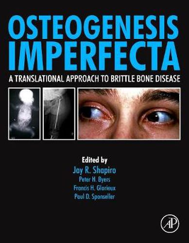Cover image for Osteogenesis Imperfecta: A Translational Approach to Brittle Bone Disease