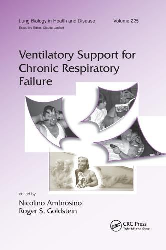 Cover image for Ventilatory Support for Chronic Respiratory Failure