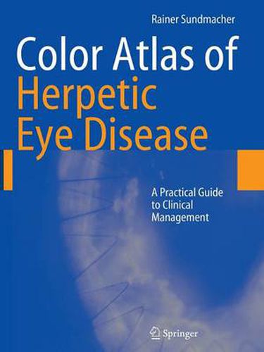 Cover image for Color Atlas of Herpetic Eye Disease: A Practical Guide to Clinical Management