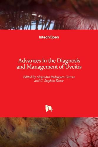 Cover image for Advances in the Diagnosis and Management of Uveitis