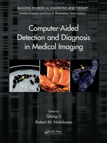 Cover image for Computer-Aided Detection and Diagnosis in Medical Imaging