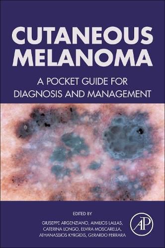 Cover image for Cutaneous Melanoma: A Pocket Guide for Diagnosis and Management