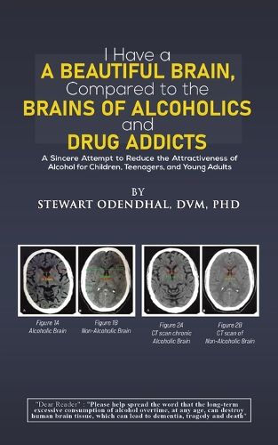 Cover image for I Have a Beautiful Brain, Compared to the Brains of Alcoholics and Drug Addicts