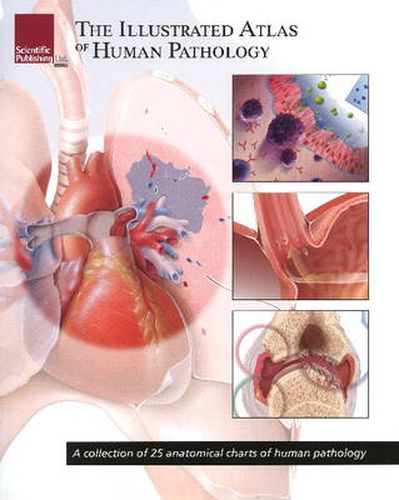 Cover image for Illustrated Atlas of Human Pathology: A Collection of 25 Anatomical Charts of Human Pathology